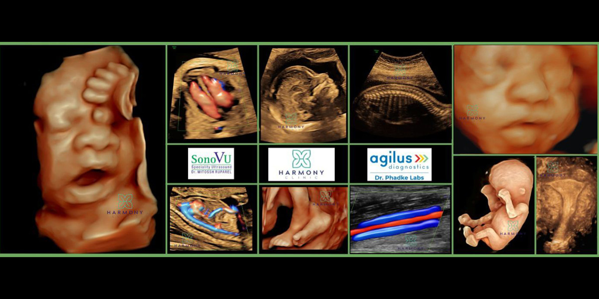 Best Sonography & Pathology Centre in Khar Bandra Mahim